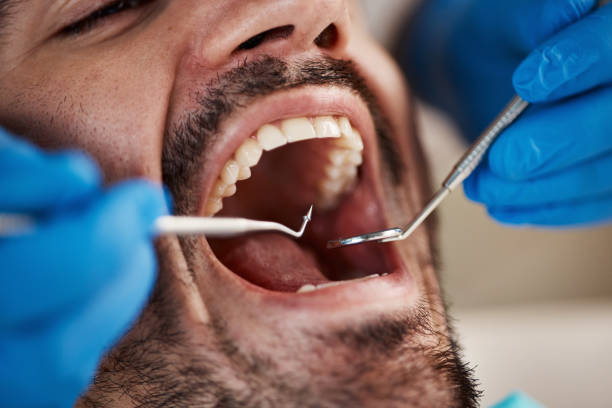 Best Emergency Tooth Extraction  in Milford Mill, MD